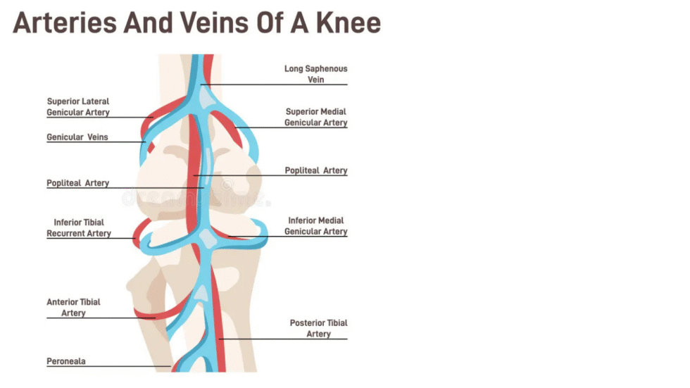 What to Expect During Genicular Artery Embolization